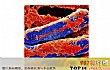 世界十大最毒东西排行榜TOP1-肉杆菌
