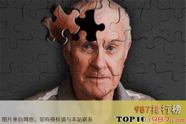 十大世界治不愈的病之alzheimer’s disease