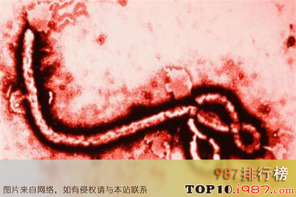 十大世界病毒之埃博拉病毒